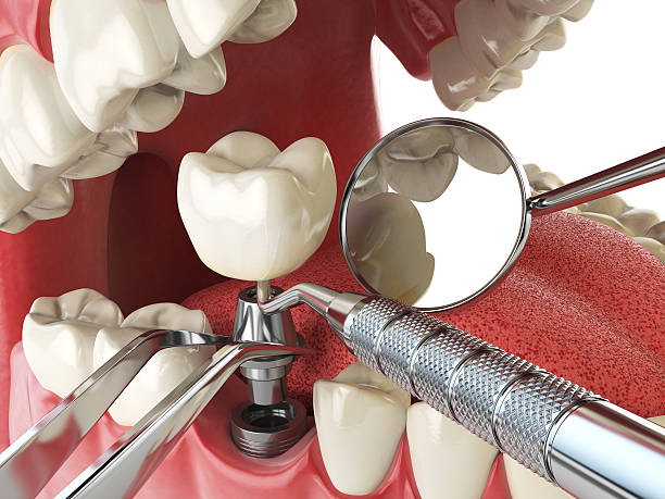 Best After-Hours Emergency Dentist in Cordova, NC